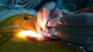  Tiếp tục phẫu thuật cấy ốc tai điện tử thành công tại Bệnh viện Trường Đại học Y Dược Huế